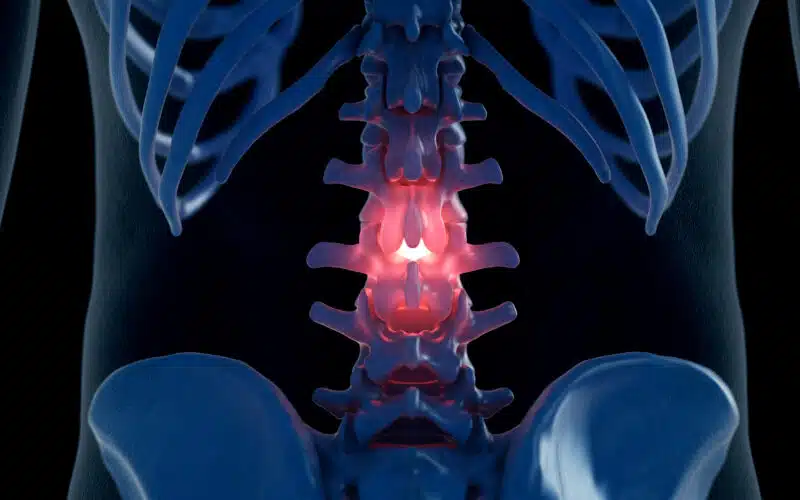 Lumbar Spine Back Pain