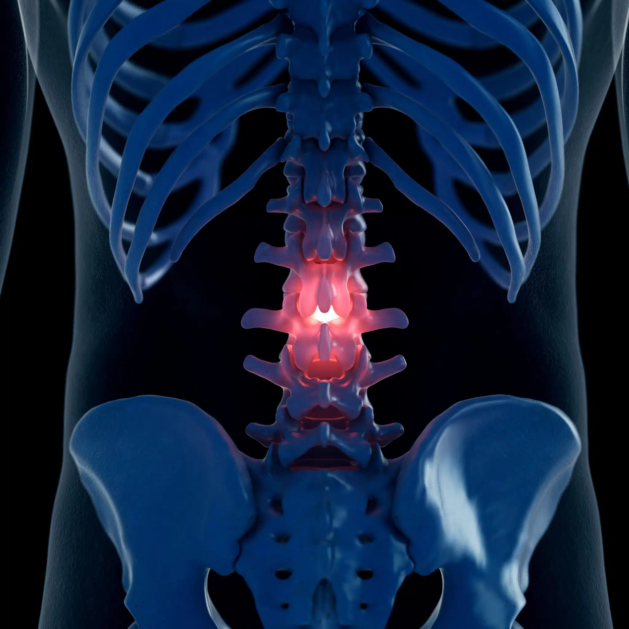 Lumbar Spine Back Pain