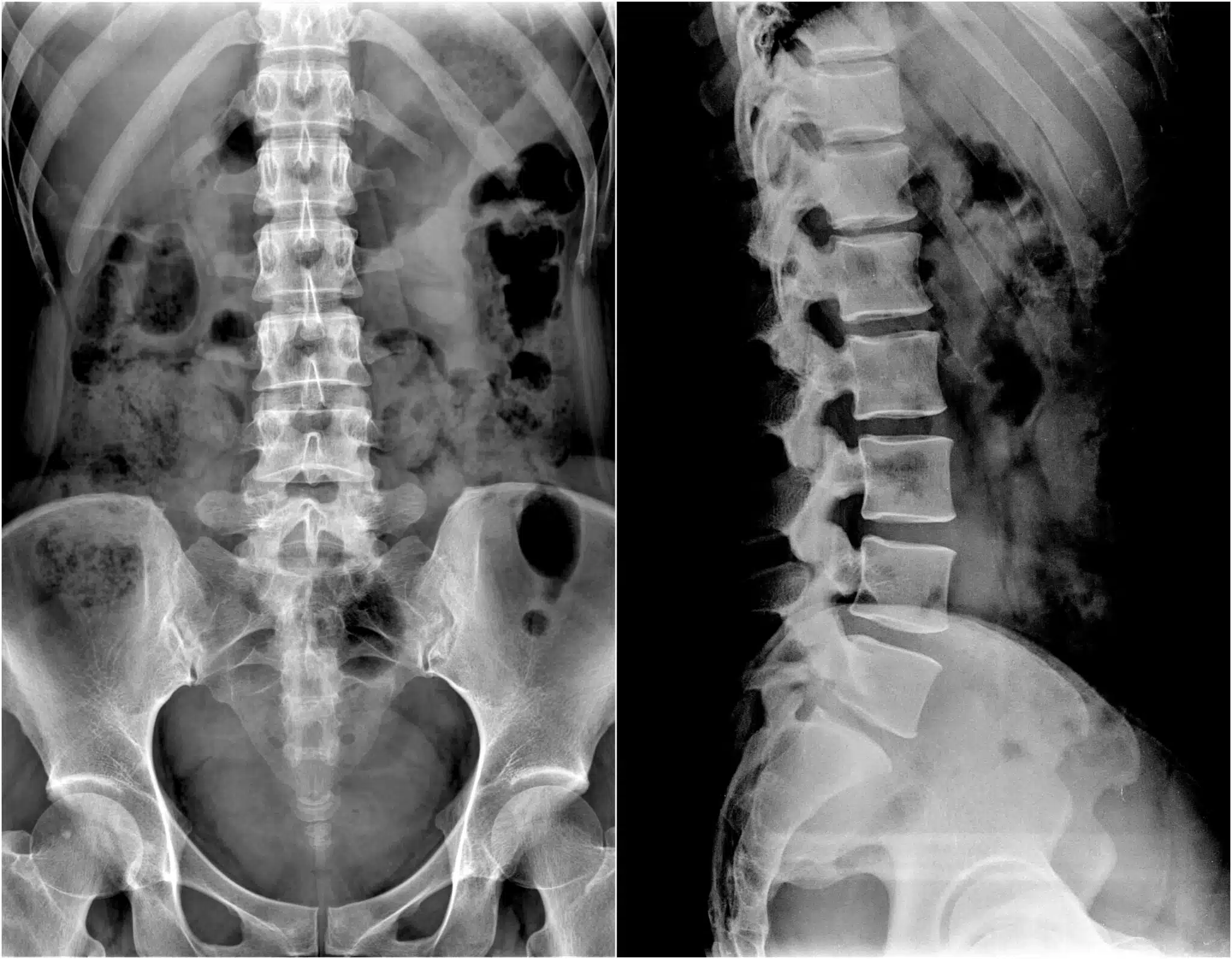 Body Scanner - Single View X-Ray