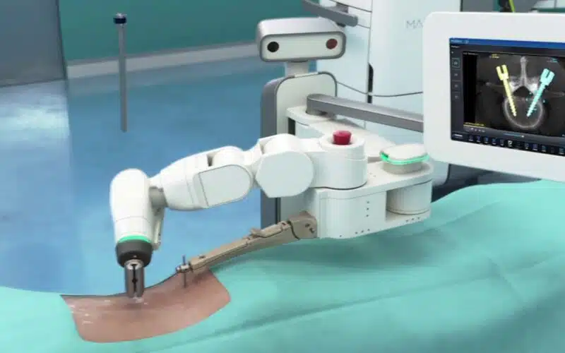 Robotic Surgery with Mazor X