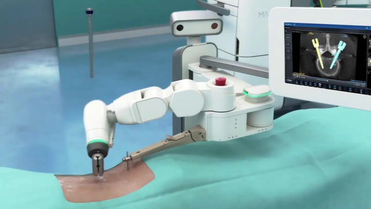 Robotic Surgery with Mazor X