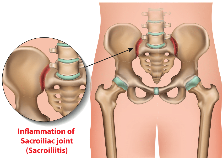 sacroiliac joint