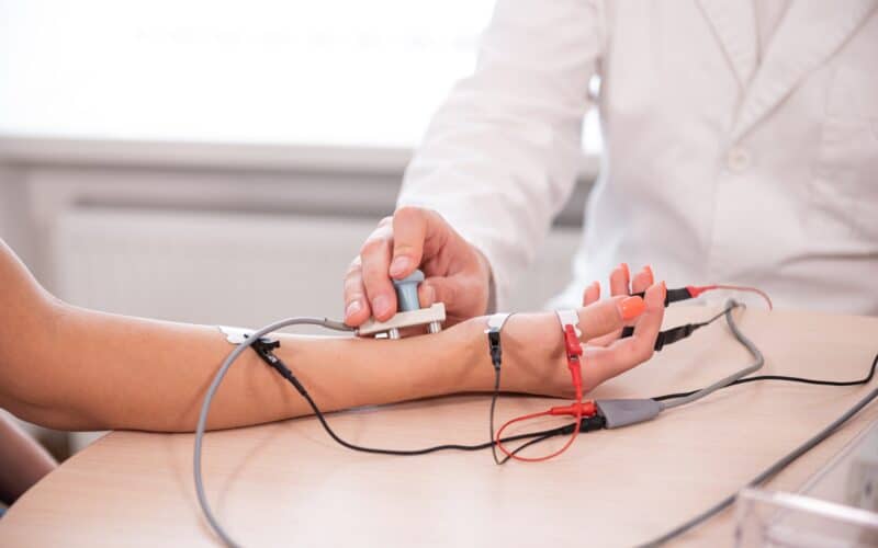 Nerve conduction study