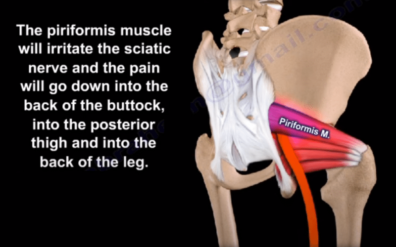 Piriformis Muscle
