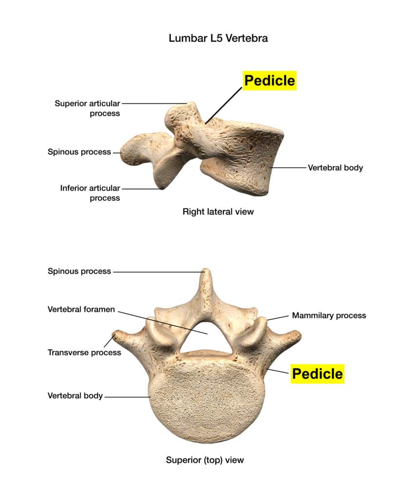 Pedicle 