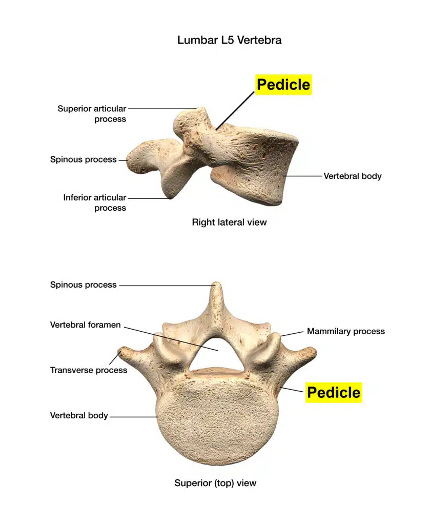 Pedicle